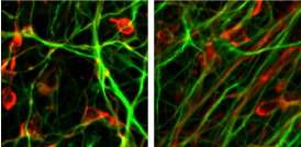 Virus-free embryonic-like stem cells made from skin of Parkinson's disease patients