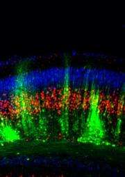 Yale team finds mechanism that constructs key brain structure