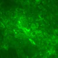 Liver cells created from patients' skin cells