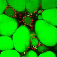 Fat cells reach their limit and trigger changes linked to type 2 diabetes