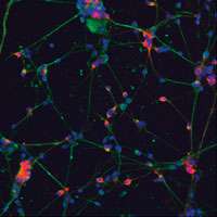 Initiative hopes to expedite cell-based treatments for Parkinson's