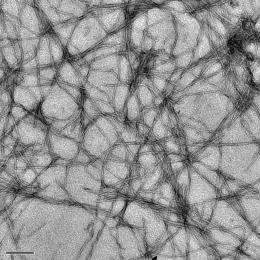 Molecules 'light up' Alzheimer's roots