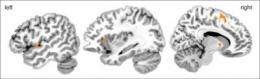 Amygdala detects spontaneity in human behavior