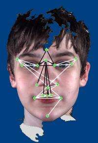 Autistic facial characteristics identified