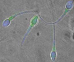 Sperm coat protein may be key to male infertility
