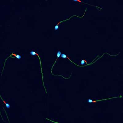 Sperm discoveries shed light on infertility and birth control