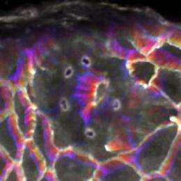 Using lasers to vaporize tissue at multiple points simultaneously