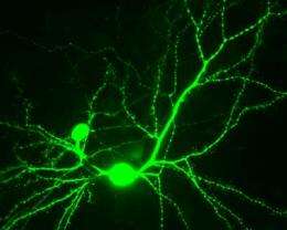 Research finds enzyme disrupting nerve cell communication in Alzheimer's disease
