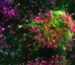 Scientists recreate brain cells from skin cells to study schizophrenia safely