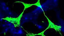 Shedding light on cell mechanism which plays a role in such diseases as Huntington's and Parkinson's