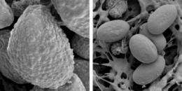 Size matters -- in virulent fungal spores -- and suggests ways to stop a killer