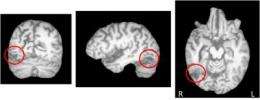 Neuroscientists uncover neural mechanisms of object recognition