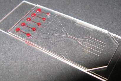 New blood analysis chip could lead to disease diagnosis in minutes