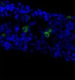 Yale researchers use uterine stem cells to treat diabetes