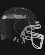 Breakthrough: Real-time data recorded on football player captures impact that caused broken neck