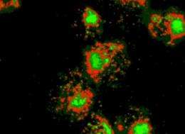 Breakthrough technology in identification of prostate cancer cells