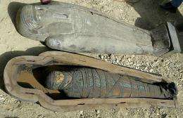 Oldest case of clogged arteries in Egypt mummy: study