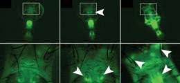 A radar for ADAR: Altered gene tracks RNA editing in neurons