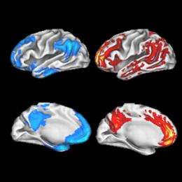 Cells talk more in areas Alzheimer's hits first, boosting plaque component