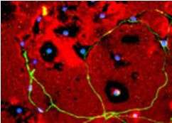 New clues to why nerve cells fail to grow in scar tissue