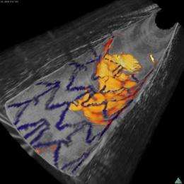 Combined arterial imaging technology reveals both structural and metabolic details