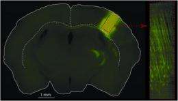 Deeper insight in the activity of cortical cells