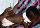 Final child vaccinated in clinical trial of new TB vaccine