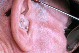 Government needs to listen up on hearing aids