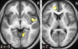 Hedging your bets: How the brain makes decisions about related bits of information