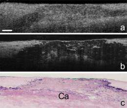 High-resolution imaging technology reveals cellular details of coronary arteries