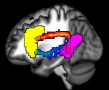 How the brain strings words into sentences