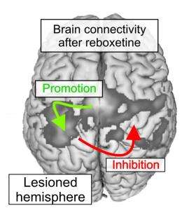 Improving post-stroke rehabilitation with neurotransmitter