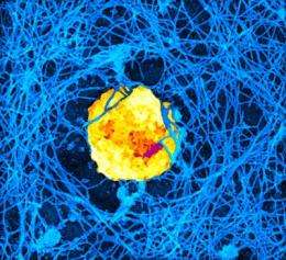 In immune cells, 'super-res' imaging reveals natural killers' M.O.