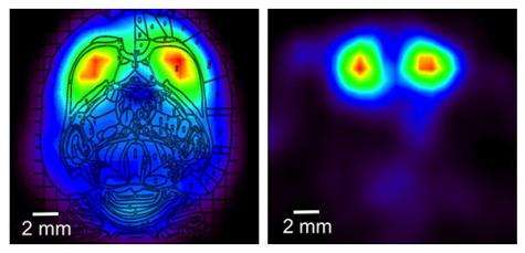 Miniature 'wearable' PET scanner ready for use (w/ Video)