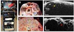 Near-infrared imaging system shows promise as future pancreatic cancer diagnostic tool