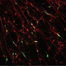 Nerve cells grown from stem cells give new insight into Parkinson's