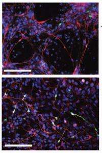 Neurons grown from skin cells may hold clues to autism