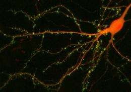 Neuroscientists discover new 'chemical pathway' in the brain for stress