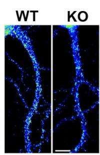 New clue found for Fragile X syndrome-epilepsy link