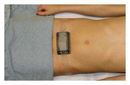 Non-invasive wireless near-infrared device provides reliable diagnosis of bladder dysfunction