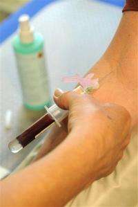 Progress is seen on a blood test for Alzheimer's (AP)