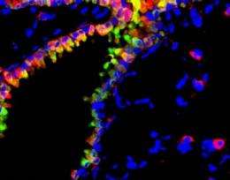 Rebooting the system: Immune cells repair damaged lung tissues after flu infection
