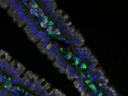 Researchers define a new type of secretory cell in the intestine