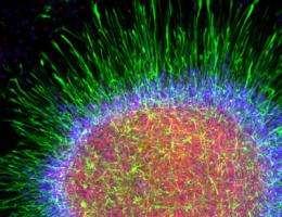 Scientists cultivate human brain's most ubiquitous cell in lab dish