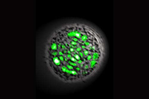 Single Green Fluorescent Protein-expressing cell is basis of living laser device