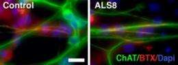 干细胞模型为继承的ALS提供了线索