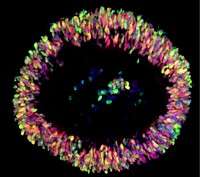 Stem cells from patients make 'early retina in a dish'