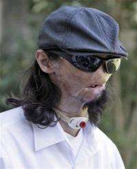 Texas man gets first full face transplant in US (AP)