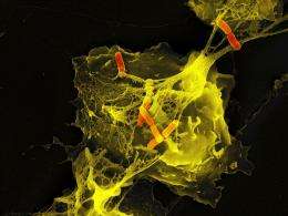 The tangled NETs of the immune system