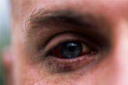 With diabetes, untreated depression can lead to serious eye disease